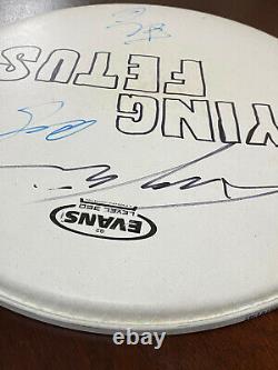 Dying Fetus Signed Autographed Drum Head Metal Band Merch Tour